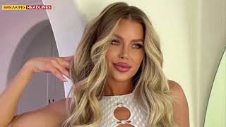 Skye Wheatley reacts to backlash over her cosmetic surgeries  Us Entertainment News [upl. by Der]