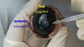 structure of eye eye dissection [upl. by Ainav521]