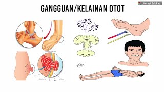 Kelainan Otot atau Gangguan Otot Manusia dan Fungsi Otot [upl. by Ytok986]