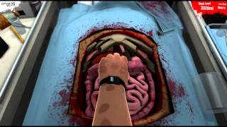 Surgeon Simulator 2013 Steam Edition  Kidney Transplant Operation PC Gameplay HD [upl. by Nareik]