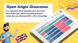 Open Angle Glaucoma  Ophthalmology [upl. by Strawn]