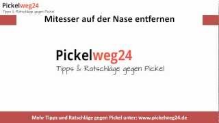 4 Tipps  Mitesser auf der Nase entfernen [upl. by Aicertal735]