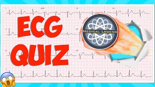 Are You A Medical Legend Test Your Knowledge With This Ecgekg Quiz electrocardiogram [upl. by Imuya]