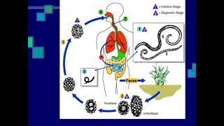 Helminths infection [upl. by Wynne]