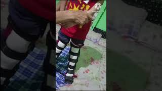 Cerebral palsy AFOOrthosis support [upl. by Aynat]