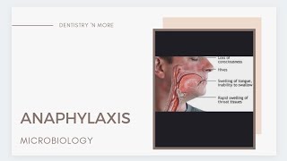 ANAPHYLAXIS amp ITS MANAGEMENT [upl. by Noral]