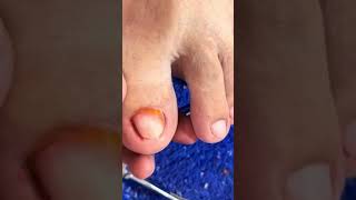 Satisfying Toe Cleaning  Relaxing Foot Care amp Deep Clean ASMR [upl. by Oswell891]