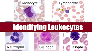 Identifying Leukocytes [upl. by Akiehsat]