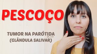 Pescoço  tumor na parótida glândula salivar [upl. by Binette353]