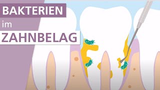 Behandlung von Parodontitis  Stiftung Gesundheitswissen [upl. by Zela]