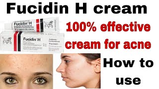 fucidin h cream uses in urdu For skin treatment of acne skin infectionsHow to use fusidin h cream [upl. by Htebazil]