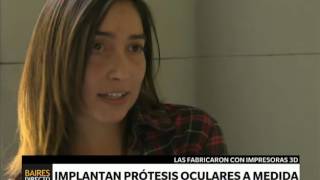 Implantan prótesis oculares a medida  Telefe Noticias [upl. by Imak827]