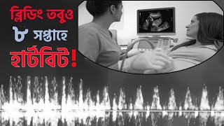 ব্লিডিং হয়ার পরে ও বাচ্চার হার্টবিট এসেছে।Bleeding in 8 weeks [upl. by Amargo]