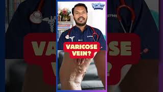 Say GOOD BYE to varicose vein Dr praveen Nithins homeopathy clinicvellore treatment shorts yt [upl. by Aeslehs46]