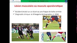 Pubalgie  physiopathologie et aspects cliniques [upl. by Leuas]