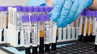 Analyse de sang  que signifie le dosage de lHBA1C hemoglobine glyquée [upl. by Sivartal]