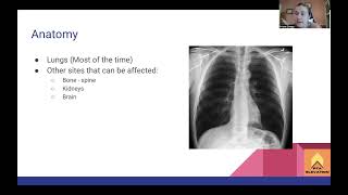 Tuberculosis  NPTEPTA Prep [upl. by Cleon]