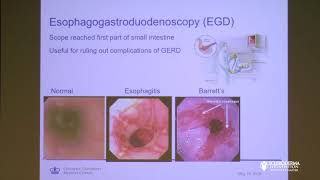 GI Dysmotility in Scleroderma Not Just the Esophagus  Daniela Jodorkovsky MD [upl. by Amieva494]