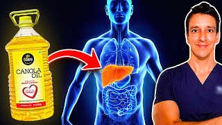 What CANOLA OIL does to your LIVER Influencers wont show you this [upl. by Nashom]