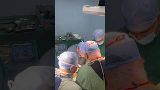 Hepatectomy I Advanced GI SURGERY I Liver Team I Surat I India [upl. by Carlyle]