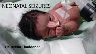 Neonatal Seizures  Pediatrics [upl. by Broddie801]