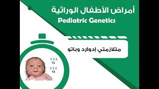 Pediatric Genetics  Edward Patau Syndromes  أمراض الأطفال الوراثية – متلازمتا إدوارد وباتو [upl. by Garrison]