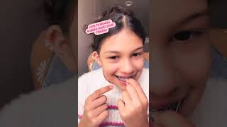 How to braces triangle rubber band using Fingers [upl. by Kevon]