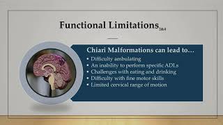 Chiari Malformations [upl. by Debbie]