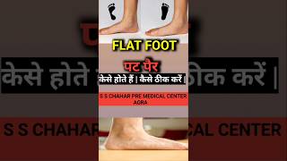 flatfoot pesplanus flatfoottreatment sscgdmedical2024 sscgdmedical2025 [upl. by Erised]