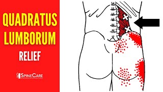 How to Fix Quadratus Lumborum Pain FOR GOOD [upl. by Oigile]