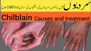 chilblain on fingers  انگلیوں کی سوجن  health really matters [upl. by Dyson]