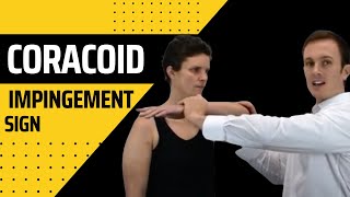 Coracoid Impingement Sign  Modified HawkinsKennedy Shoulder Impingement Test [upl. by Anerul694]