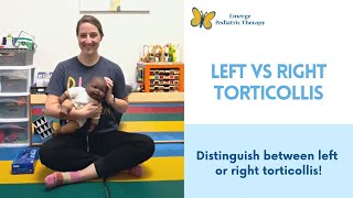 Left or Right Torticollis [upl. by Bethany]