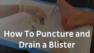 How To Puncture And Drain A Blister  Blister Treatment [upl. by Akeenahs]