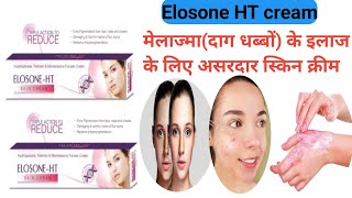 Elosone HT cream  Elosone HT cream uses in Hindi  दाग धब्बों के इलाज के लिए स्किन क्रीम shorts [upl. by Nylinnej810]