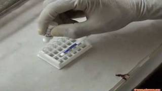 Rapid malaria test [upl. by Tristan350]