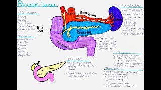 Understanding Pancreas Cancer  Risk factors Symptoms Diagnosis Treatment Classification [upl. by Tram]