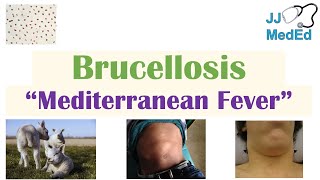 Brucellosis Mediterranean Fever  Transmission Pathogenesis Symptoms Diagnosis Treatment [upl. by Strephonn290]