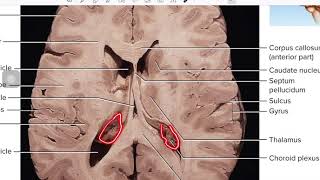 CSF and Ventricles [upl. by Ettenowtna]