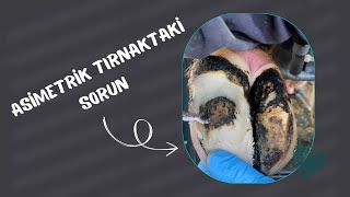 ASİMETRİK TIRNAKTAKİ SORUN [upl. by Donela]