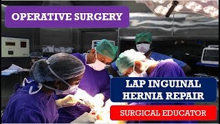 LAPAROSCOPIC INGUINAL HERNIA REPAIR STEP BY STEP OPERATIVE SURGERY [upl. by Luz]