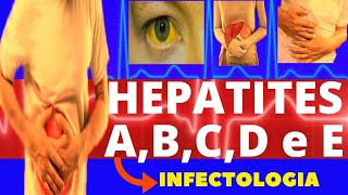 HEPATITES A B C D e E  CARACTERÍSTICAS SINTOMAS DIAGNÓSTICO E TRATAMENTO  INFECTOLOGIA [upl. by Bittencourt]