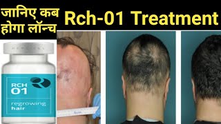 Rch01 Launching Time  Rch01 in India  Rch01 for Hairloss Baldness  Rch01 Results  Replicel [upl. by Menell]