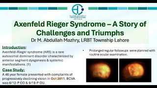 Axenfeld Rieger Syndrome – Challenges and TriumphsThe Best Poster Award AICO 2024 [upl. by Khalid]