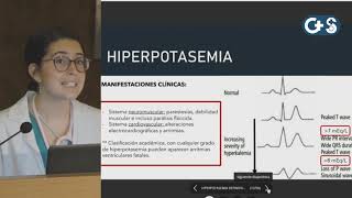 Sesión clínica Potasio como tratarlo hoy Hiperpotasemia [upl. by Gayelord10]