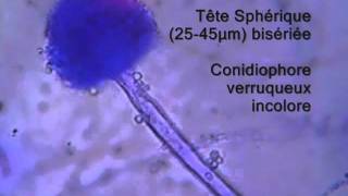 Aspergillus flavus explained [upl. by Aloeda]