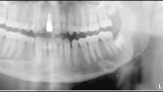 Test your panoramic anatomic landmark skill [upl. by Doty]