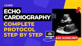 Echocardiography Standard Protocol  Step by Step  Complete Transthoracic Normal Echocardiogram [upl. by Emera]