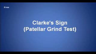 Clarkes Sigh Patellar grind test [upl. by Arinay]