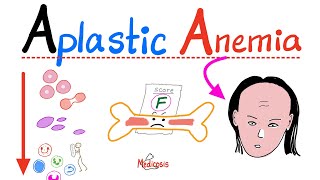 Aplastic Anemia  All you need to know  Definition Causes Symptoms Diagnosis amp Treatment [upl. by Torray]